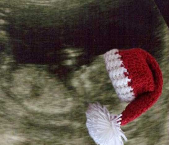Santa baby scan